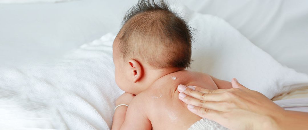 Dry Skin on Newborn and how to care for it
